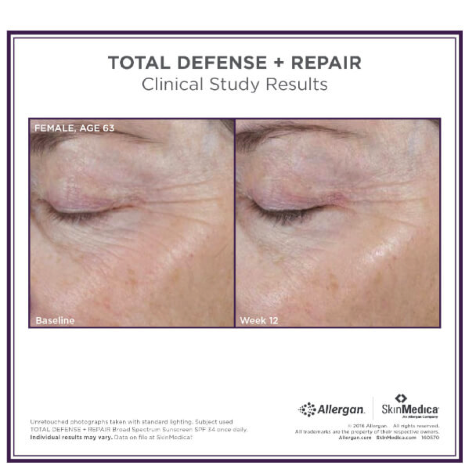 Total Defense + Repair Clinical Study Results