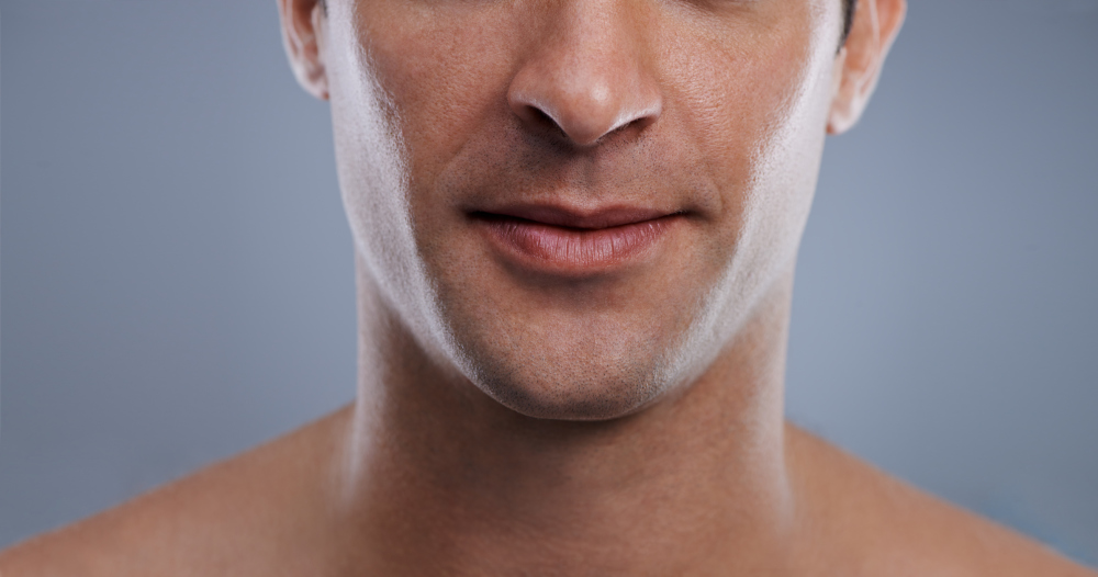 aspireMD - Belkyra - Dissolve Double Chin (Men)